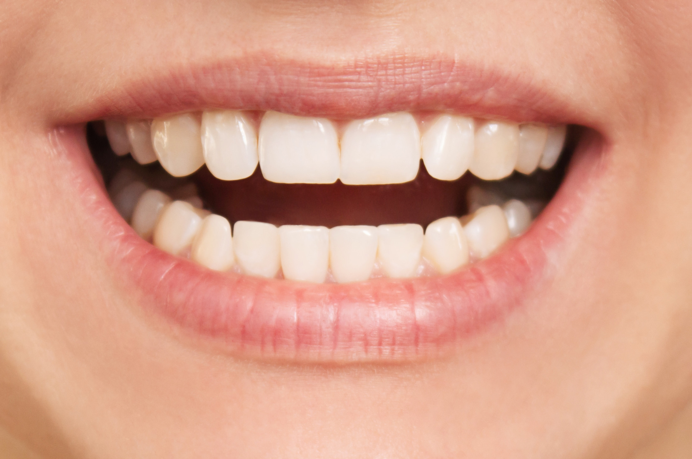 Zahnkorrektur mit Alignern – Mund mit geraden Zähnen im Unterkiefer
