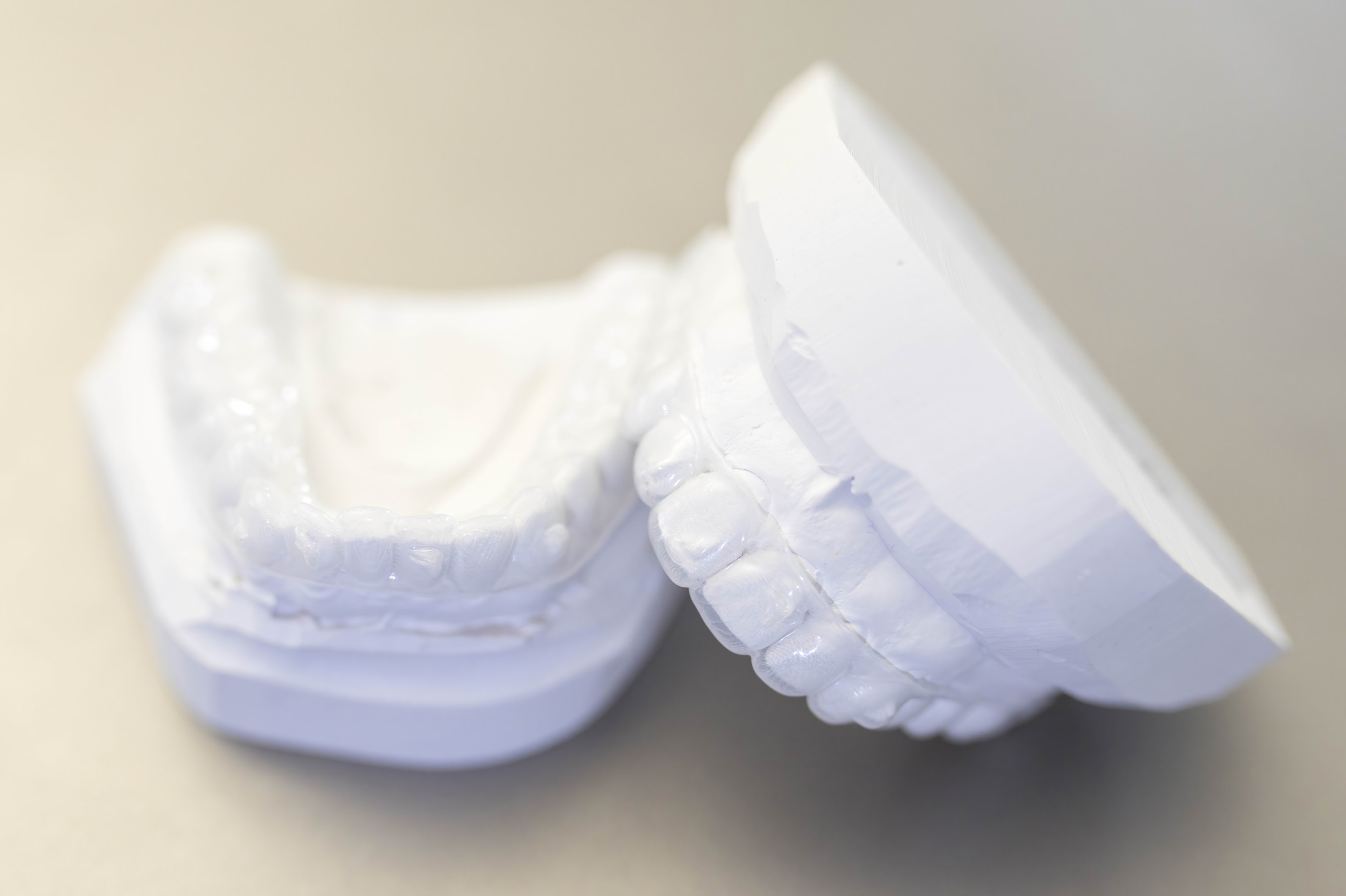 Transparente Aligner auf einem Gipsabdruck der Zähne